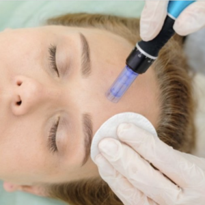 Dermapen + Infini White 10 ML